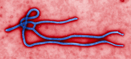 Ebola, la copertura della medicina moderna
