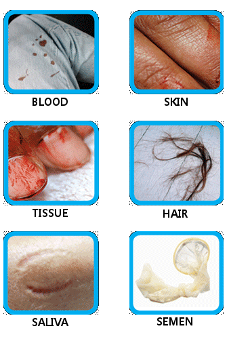 Il DNA incastra Jack? - Seconda Parte Il DNA incastra Jack? - Seconda Parte