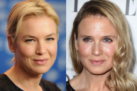 La nuova faccia di Renee Zellweger