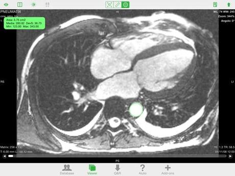 OsiriX HD DICOM PACS Viewer iPhone iPad recensione Mobimed 10