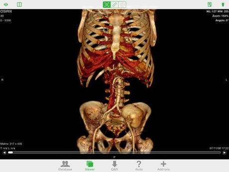 OsiriX HD DICOM PACS Viewer iPhone iPad recensione Mobimed 7