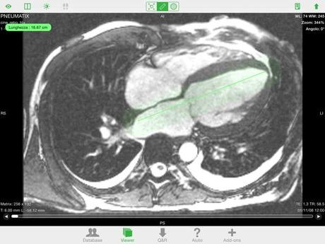 OsiriX HD DICOM PACS Viewer iPhone iPad recensione Mobimed 9