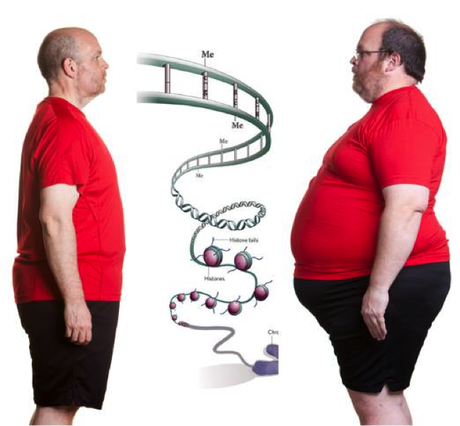 Sovrappeso e obesità, tutta colpa del gene FTO