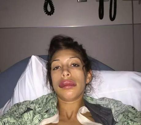 Ex Teen Mom, Farrah Abraham in ospedale: disastro con il botox
