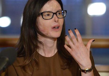 Lucia Annibali sfregiata con l’acido dall’ex fidanzato, confermati 20 anni di carcere per lui Lucia Annibali sfregiata con l’acido dall’ex fidanzato, confermati 20 anni di carcere per lui