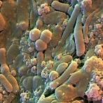 Scoperta la proteina anti obesità ? Scoperta la proteina anti obesità ?