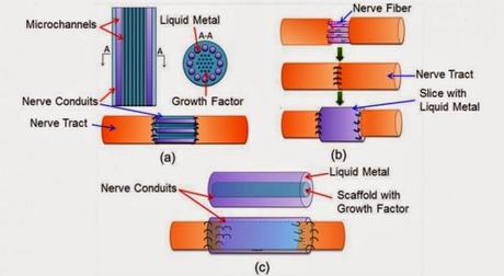 Metallo liquido utilizzato per riconnettere nervi danneggiati