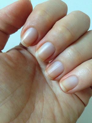 L'Oreal Nail Detox - risultati dopo 2 settimane