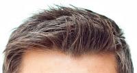Hairbro Hairbro