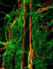 Sclerosi multipla: svelato il collegamento tra cervello e sistema linfatico