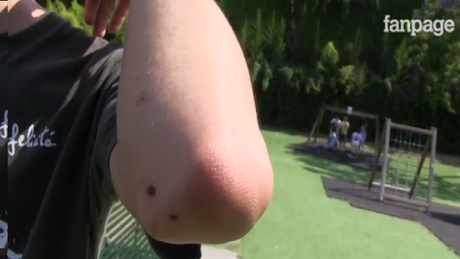 Video. Studente aggredito: “Nessuno interveniva, sono salvo grazie ad un gruppo di immigrati” Aggressione