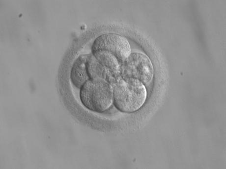 Ritratto di un embrione da giovane – #storiediscienza