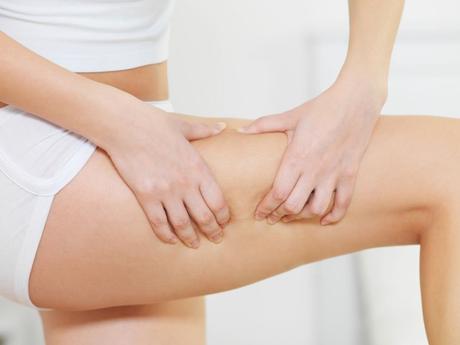 7 rimedi naturali per combattere la cellulite