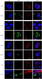 Funghi nel cervello causa Alzheimer