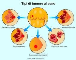 Dottor di Bella a Telecolor: MDB, prevenzione e le ultime straordinarie new’s.