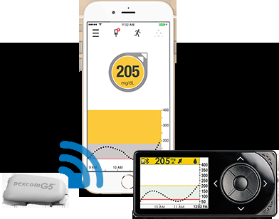 Dexcom G5: CGM da smartphone disponibile in Italia Dexcom G5 Italia