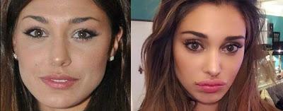 Belen Rodriguez Il mistero della chirurgia facciale di Belen