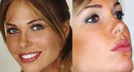Ilary Blasi si è rifatta il seno dopo il terzo figlio? No, ma… ilary-blasi-labbra-prima-e-dopo-800x540
