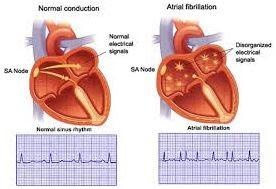 CARDIOVERSIONE ELETTRICA E MANUALE DI ECOCARDIOGRAFIA - CARDIOVERSIONE ELETTRICA E MANUALE DI ECOCARDIOGRAFIA -