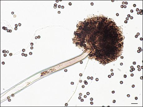 AN-PEP per risolvere la gluten sensitivity e non solo AN-PEP per risolvere la gluten sensitivity e non solo