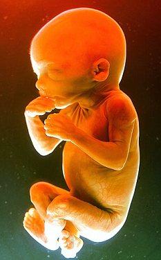 20 weeks foetus