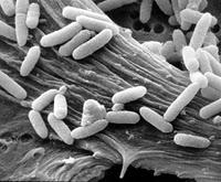 Continua il contagio da Escherichia coli, il batterio killer