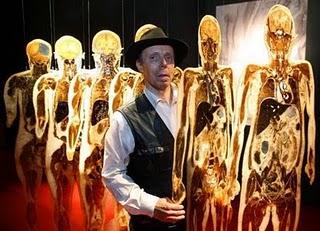 L'uomo che sbuccia cadaveri: Gunther Von Hagens