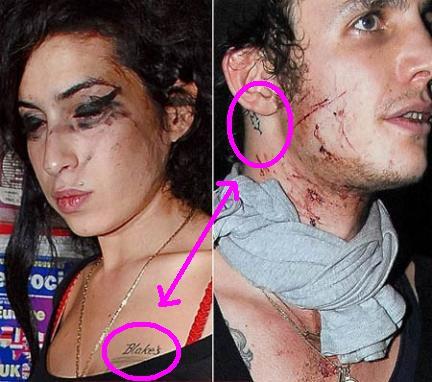 Si teme il suicidio per Blake Fielder-Civil, ex-marito di Amy Winehouse