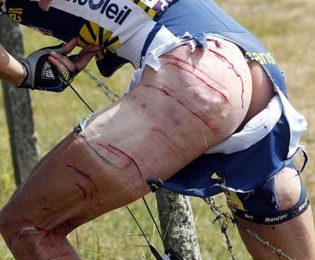 Tour de France 2011 : Hoogerland e il filo spinato (foto CHOC!) Tour de France 2011 : Hoogerland e il filo spinato (foto CHOC!)