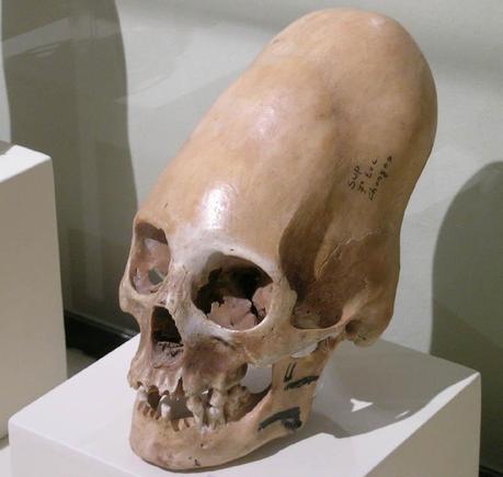 http://www.archeorivista.it/wp-content/uploads/2009/03/cranio-dolicocefalo-paracas.jpg