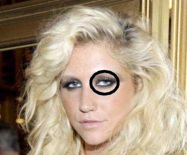 Ma Kesha ha un occhio alla rovescia?