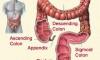 come prevenire il cancro al colon