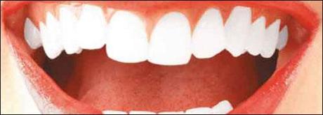 Marzo 2012 : mese della prevenzione dentale
