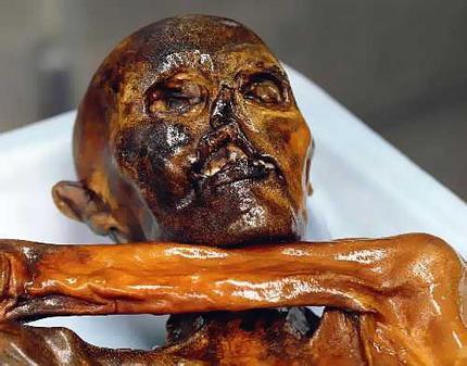 Oetzi, Etziu, la mummia del Similaun è morto di una infezione