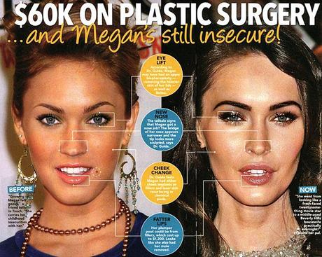 Megan Fox, 60 mila dollari in chirurgia plastica e le insicurezze non svaniscono