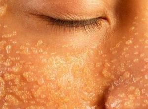 Scrub: a cosa serve e come prepararlo in casa! Scrub: a cosa serve e come prepararlo in casa!