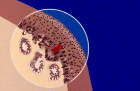 OSTEOCONDRITE/OSTEOCONDROSI NEL CANE