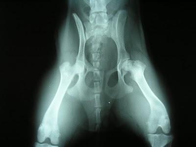 LEGG- PERTHES- CALVE' CANE