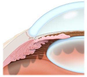 IL GLAUCOMA NEL CANE E NEL GATTO