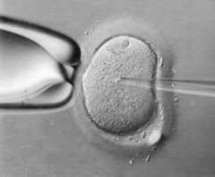 FECONDAZIONE IN VITRO