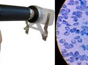 CellScope: trasforma cellulare microscopio