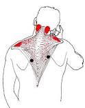 Dolori spalla più dolori al collo uguale cervicale. Combattiamola insieme