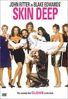 Skin Deep - Blake Edwards