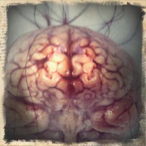 Brains:The Mind as Matter