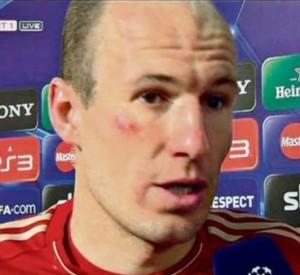 FOTO-CURIOSITA’-Robben aggredito nell’intervallo del match di Champions contro il Real da….