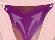 Contraccezione definitiva: novità Essure