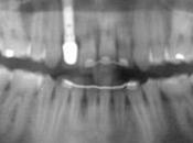 Analisi radiologiche denti: pericolo salute?