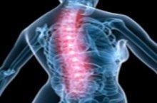 Osteoporosi: combatte vitamina