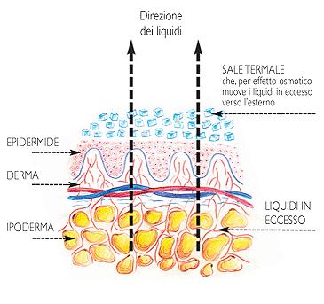 Varici arti inferiori e cellulite