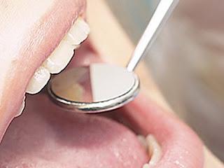 Nanoparticelle combattono la carie e ricostruiscono i denti